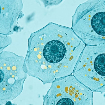 Close-up microscope image of human cells with a teal and yellow color palette, showing cell nuclei and internal structures in detail.